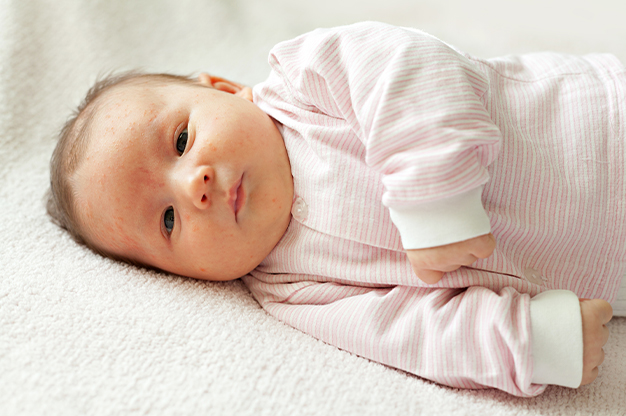 Trẻ sơ sinh ra mồ hôi đầu là hiện tượng không đáng lo ngại