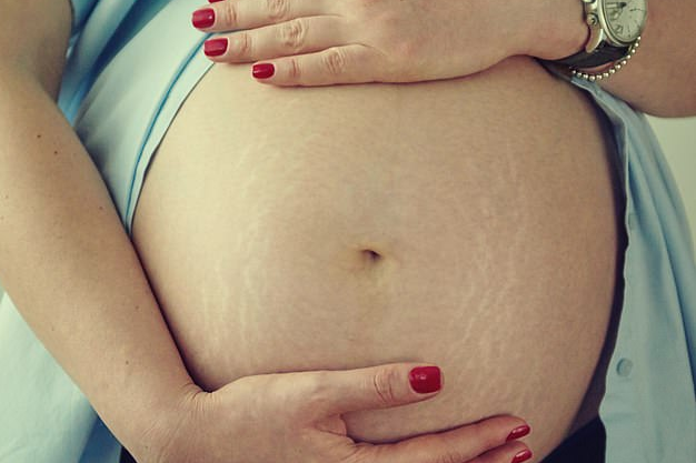 Những nguyên nhân gây rạn da khi mang thai các mẹ cần biết