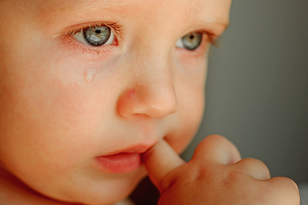 Khi trẻ bị chảy nước mắt nhiều kèm theo ghèn nhưng mắt không đỏ hay kích ứng thì đó chính là dấu hiệu của tắc ống dẫn nước mắt