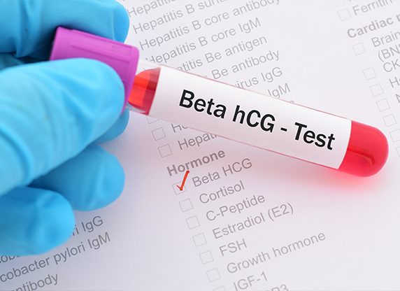Beta HCG quan trọng như nào mà mẹ bầu nên biết?