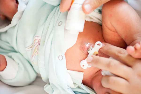 6 điểm cần lưu ý khi chăm sóc bé sơ sinh chưa rụng rốn