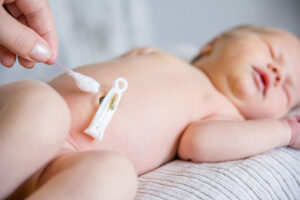 Chăm sóc rốn bé sơ sinh ĐÚNG CÁCH tránh nguy cơ nhiễm trùng