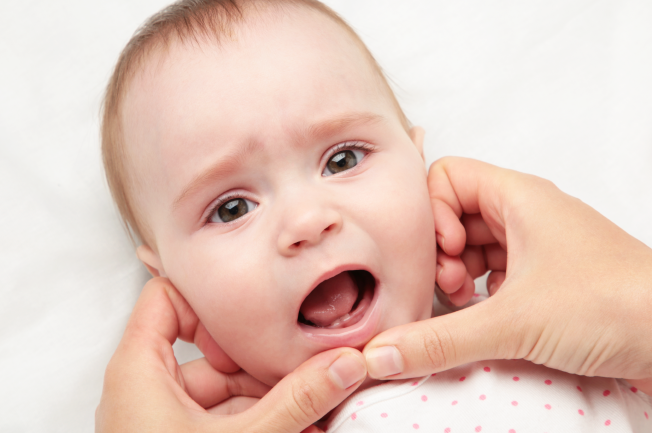 Mẹ cần lưu ý điều gì khi chăm sóc bé bị nấm lưỡi?