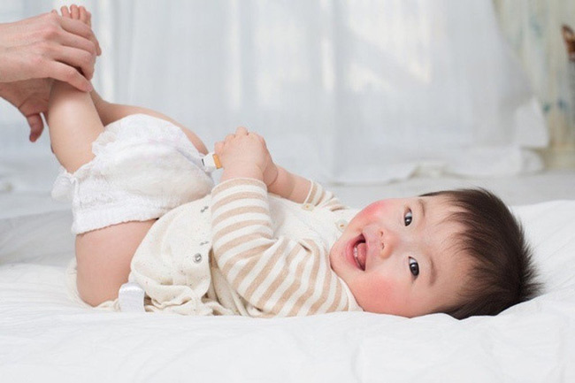 Đóng bỉm sai cách có thể khiến bé bị hăm tã