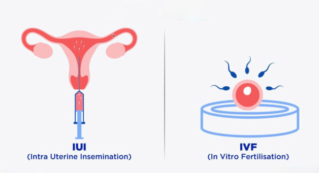 Tính tuổi thai IUI và IVF chính xác 99% do xác định đúng ngày rụng trứng