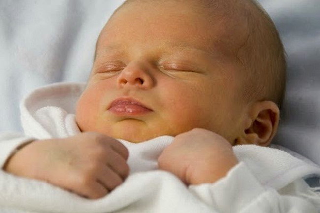 Vàng da sơ sinh là vấn đề thường gặp và không nguy hiểm với bé