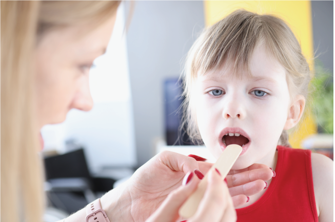 Tình trạng nhiễm trùng các vết thương nhỏ trong miệng là nguyên nhân gây nhiệt miệng ở trẻ nhỏ