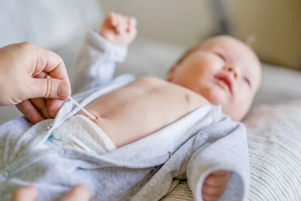 Vệ sinh rốn cho bé sau khi rụng thế nào để đảm bảo sức khỏe cho con?