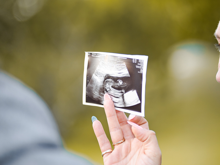 Phát hiện sớm vấn đề của con nhờ siêu âm thai 3 tháng đầu