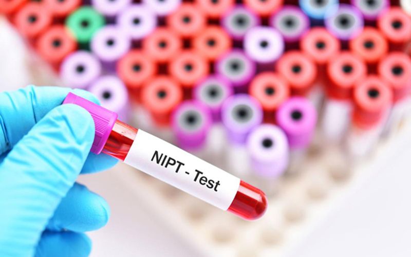 Xét nghiệm NIPT giúp phát hiện dị tật thai nhi từ tuần thứ 10