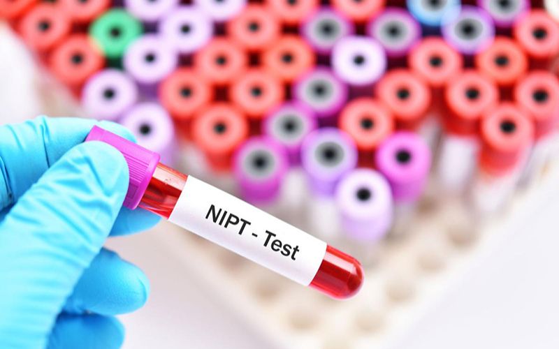 Kết quả xét nghiệm NIPT có độc chính xác 99%