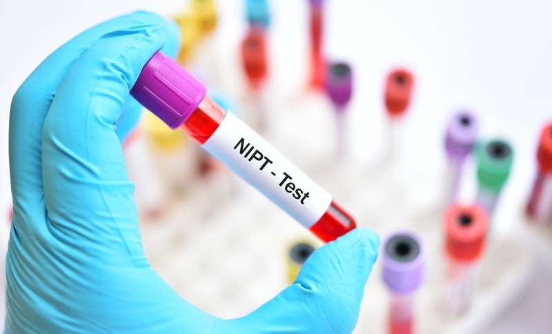 Xét nghiệm NIPT là gì? Ưu điểm của phương pháp sàng lọc NIPT