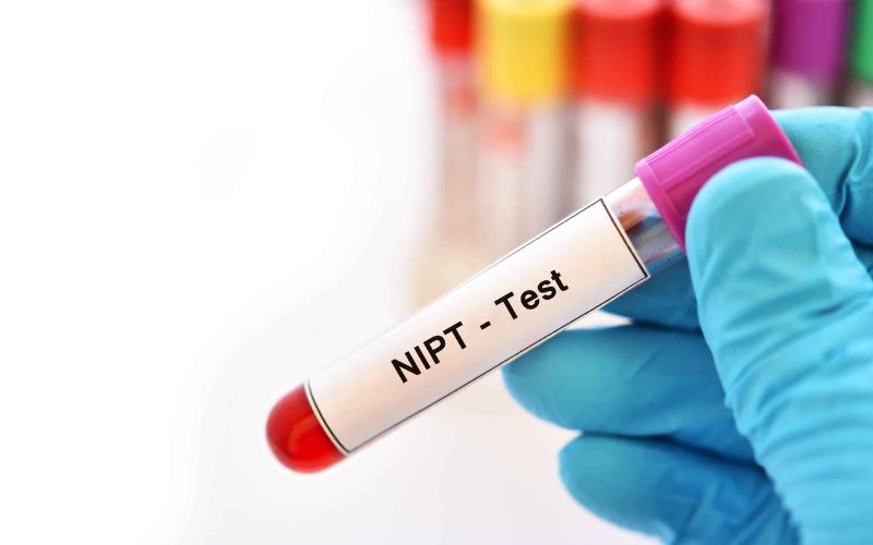 Xét nghiệm NIPT thực chất là gì 