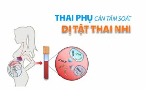 Khi nào nên thực hiện Double test Triple test và NIPT