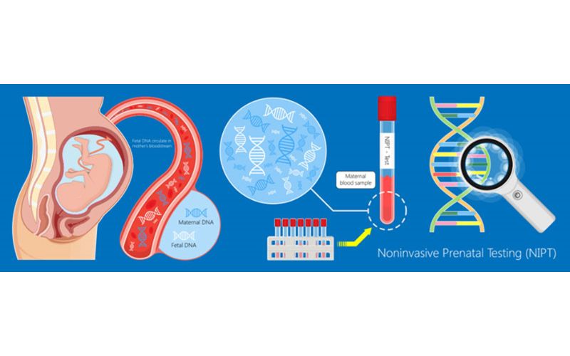 Nên tham khảo ý kiến bác sĩ khi thực hiện Double test Triple test và NIPT